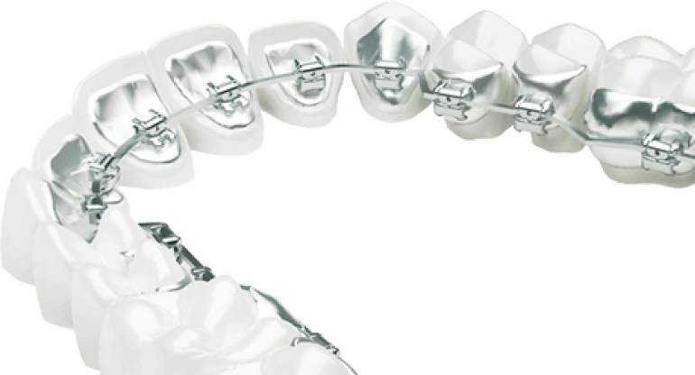 Изгибы на дугах