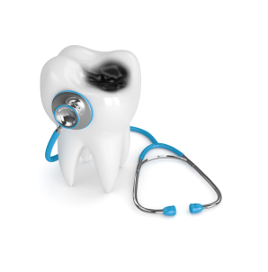 Лечение зубов