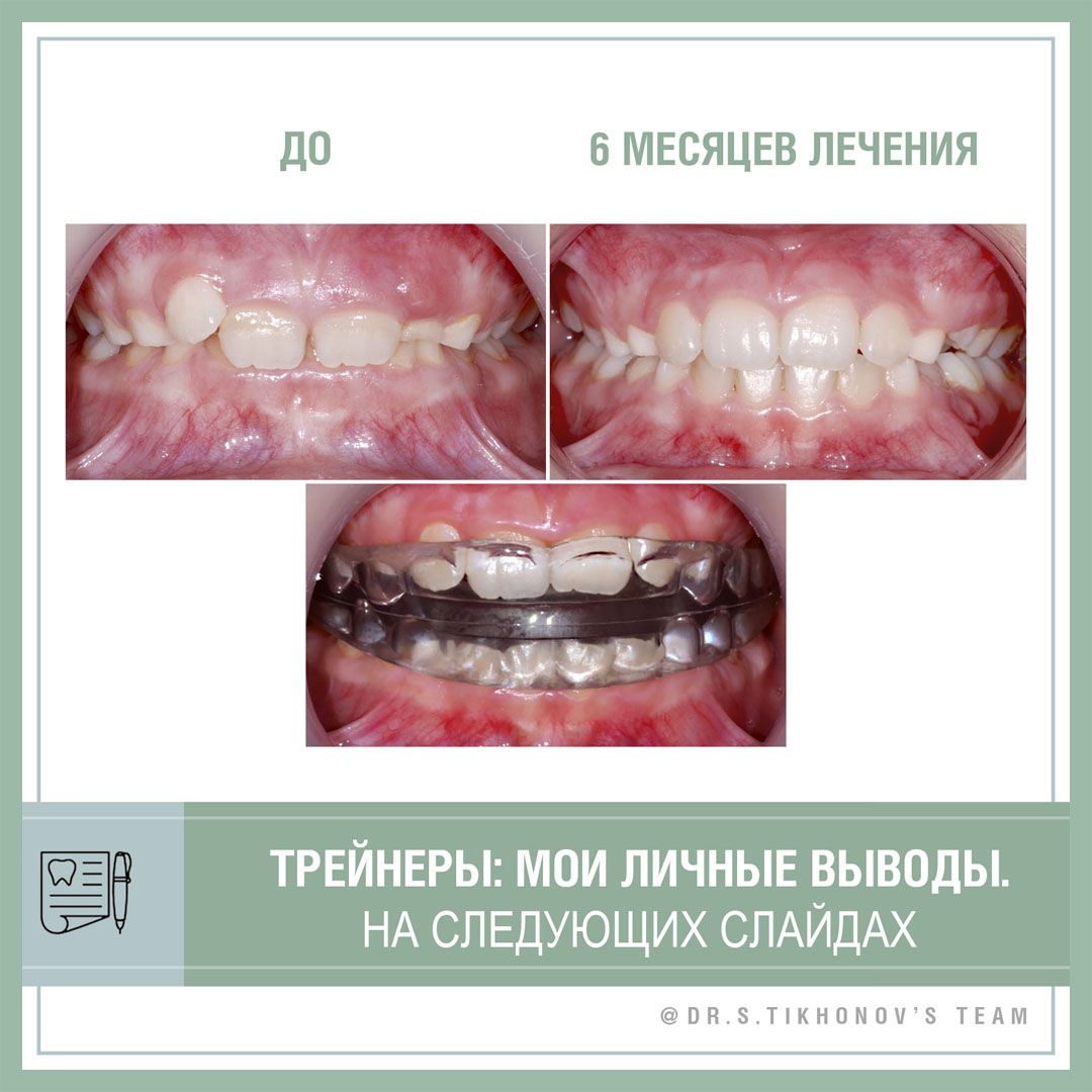 Трейнеры: личные выводы Сергей Тихонова