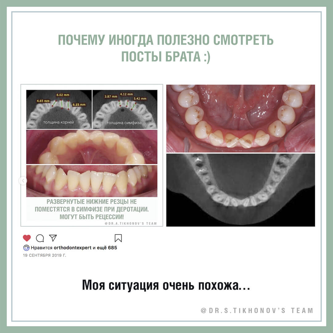 Почему иногда полезно читать посты брата