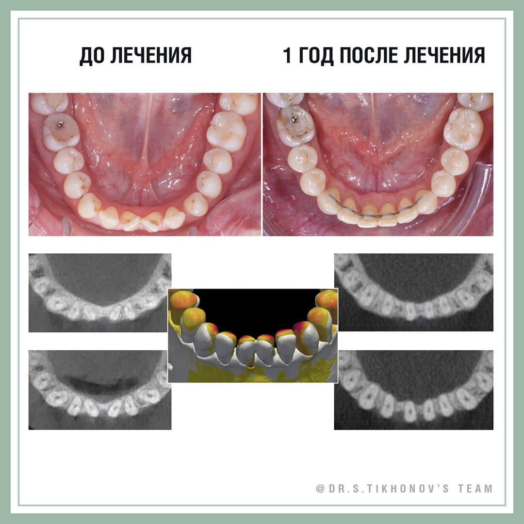 Чему нас учат «пародонтологические пациенты»?