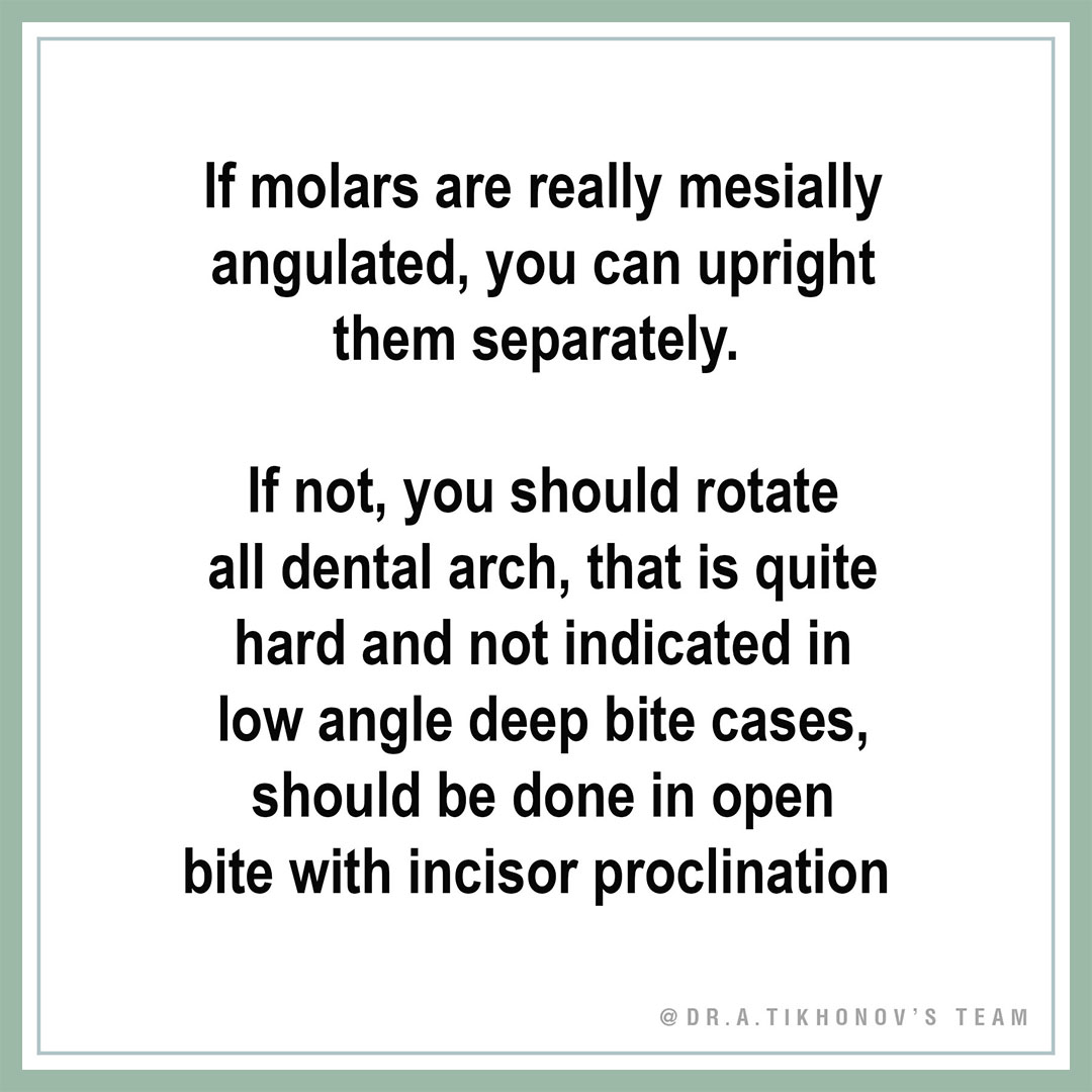 Если моляры действительно наклонены мезиально, вы можете выровнять их по отдельности.