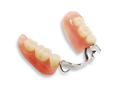 Бюгельные зубные протезы