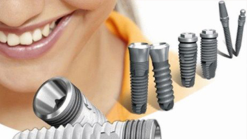 Какие имплантаты лучше