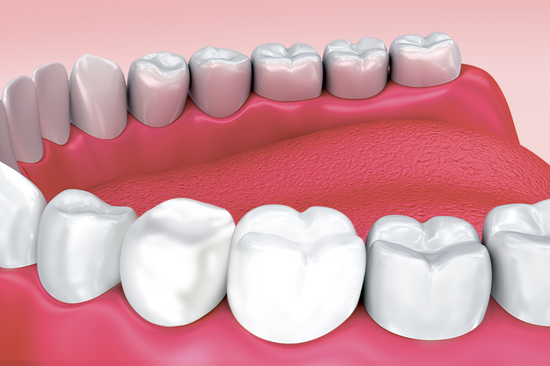 Акриловые зубные протезы