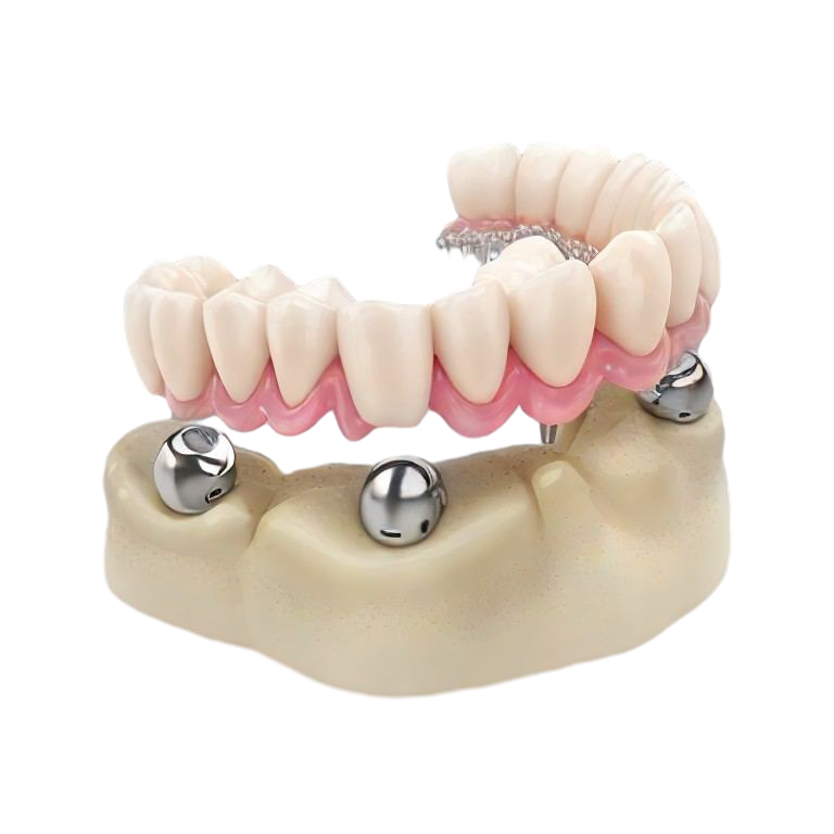 Телескопические зубные протезы
