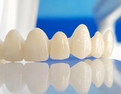 Виды зубных протезов: съемное и несъемное протезирование