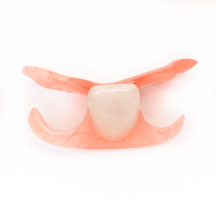 Зубные протезы “бабочка”