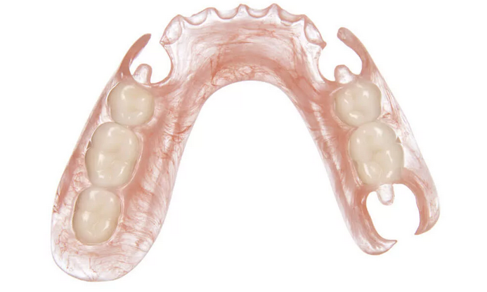 Зубные протезы без неба