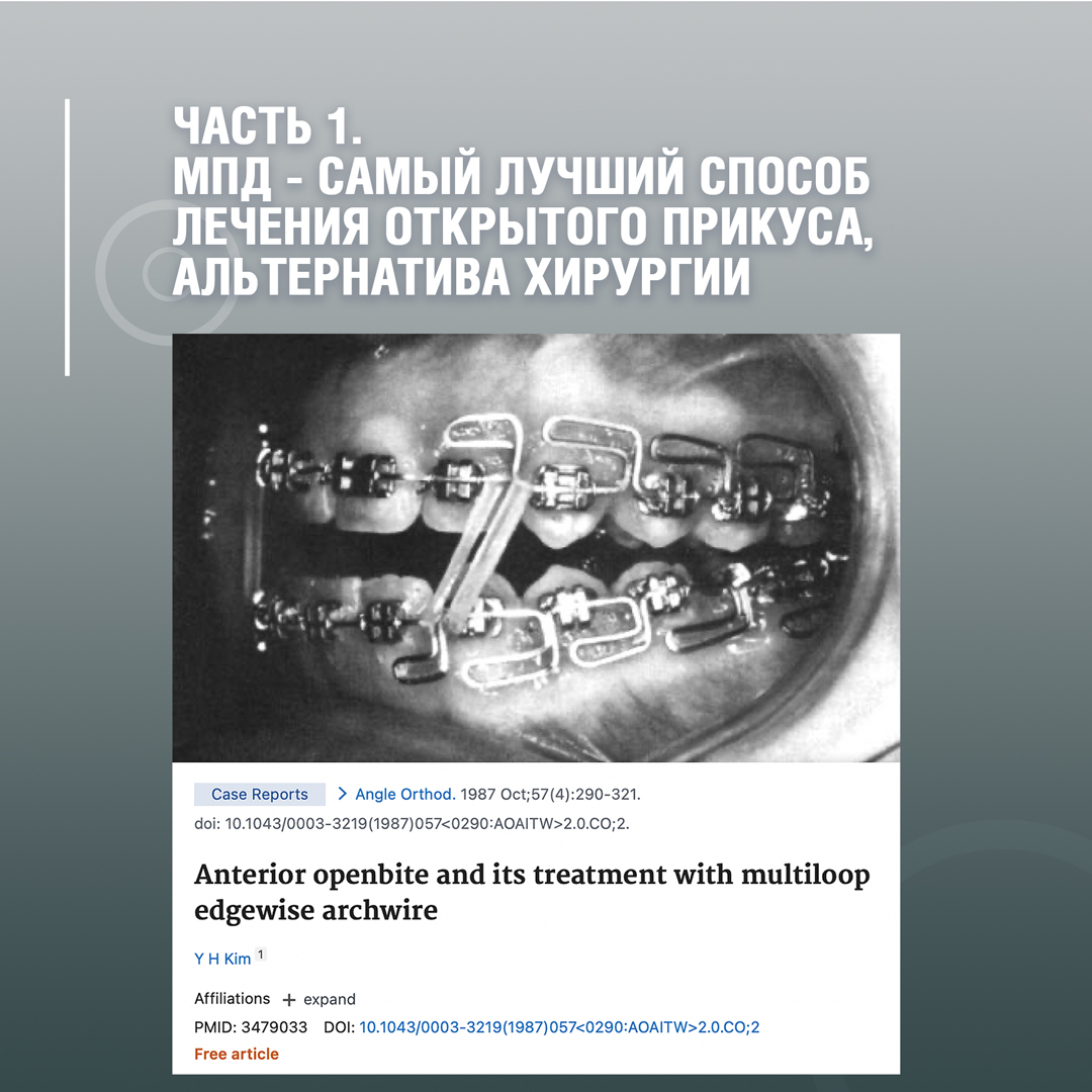 МПД - самый лучший способ лечения открытого прикуса