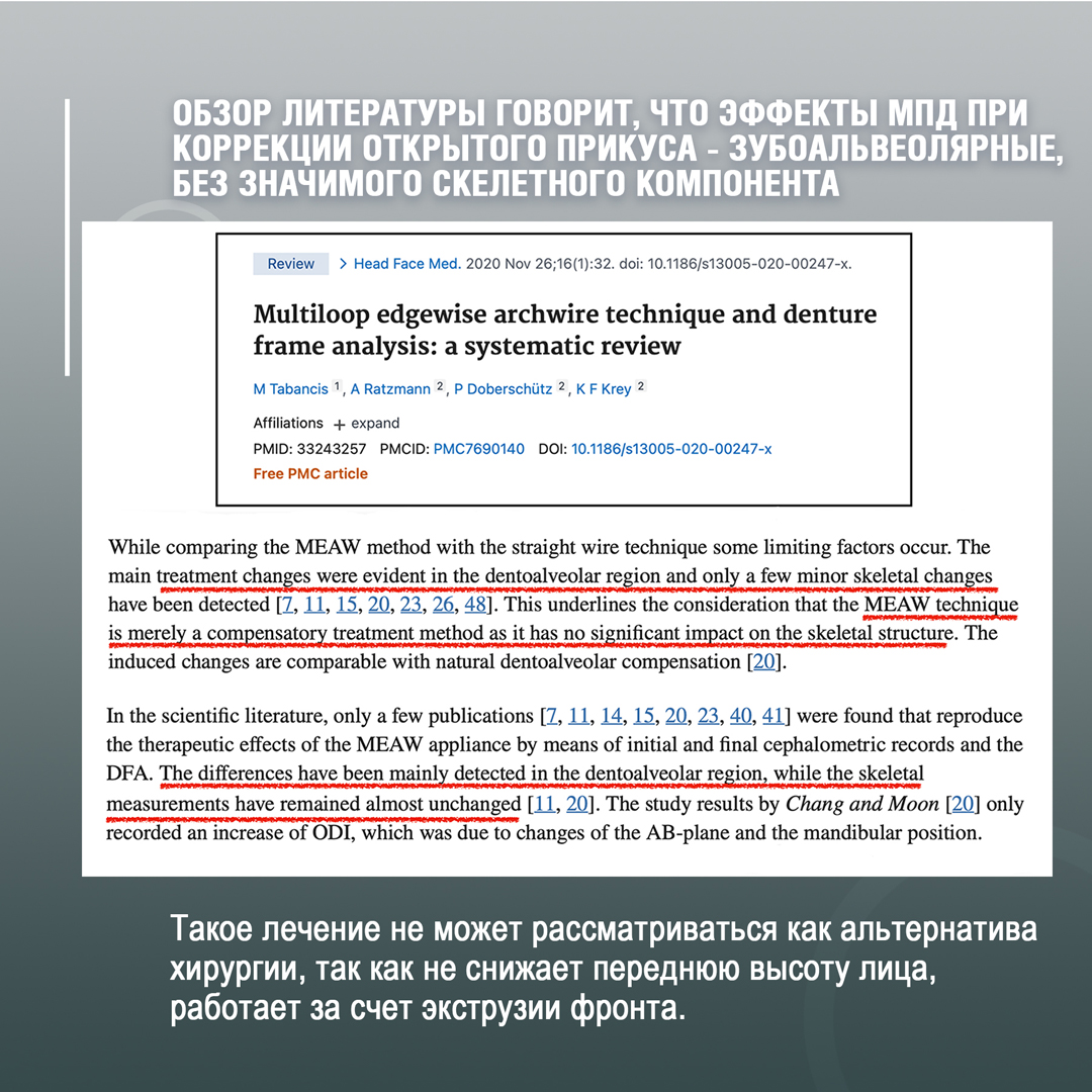 Обзор литературы говорит, что эффекты МПД при открытии молярного прикуса зубоальвеолярные