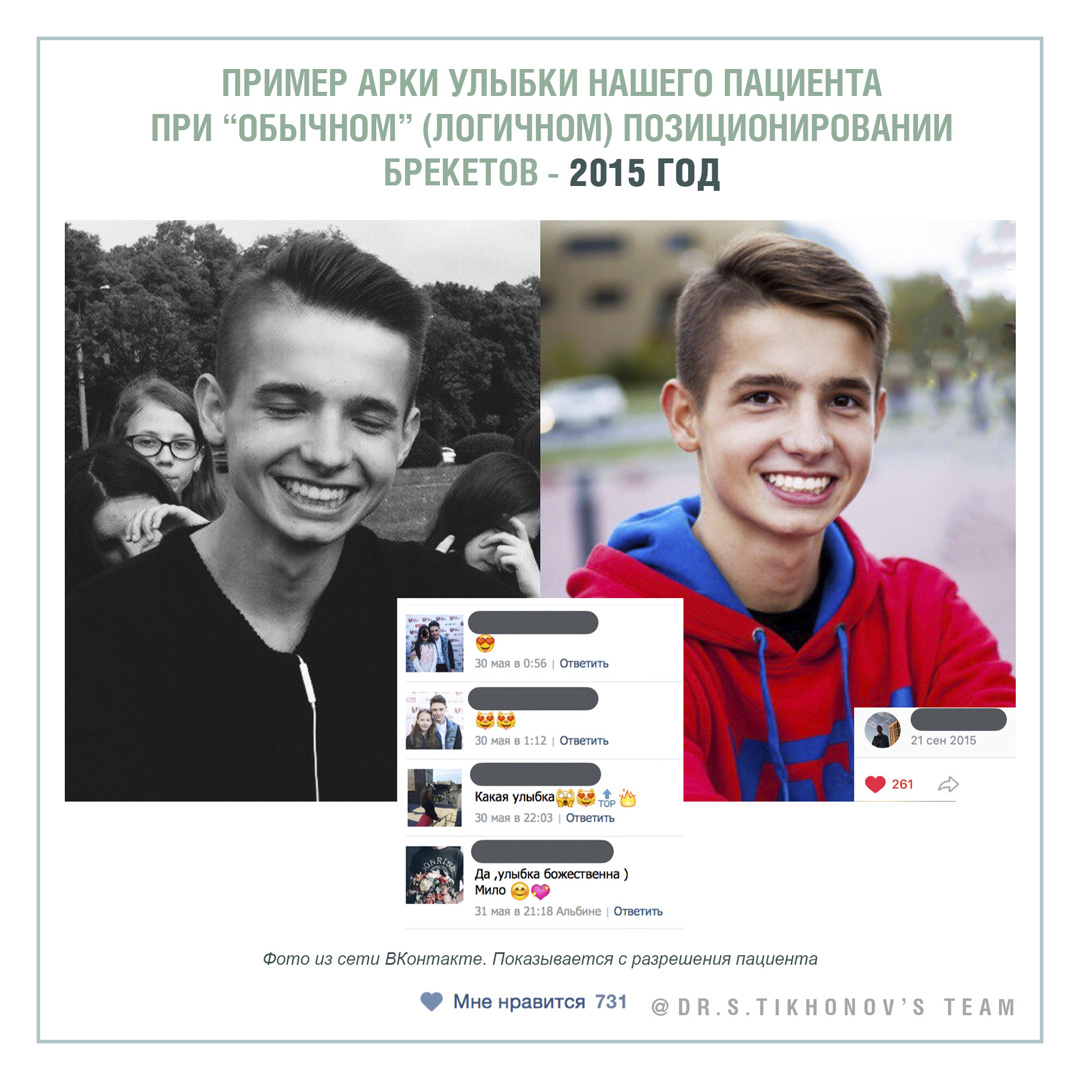 Пример арки улыбки нашего пациента