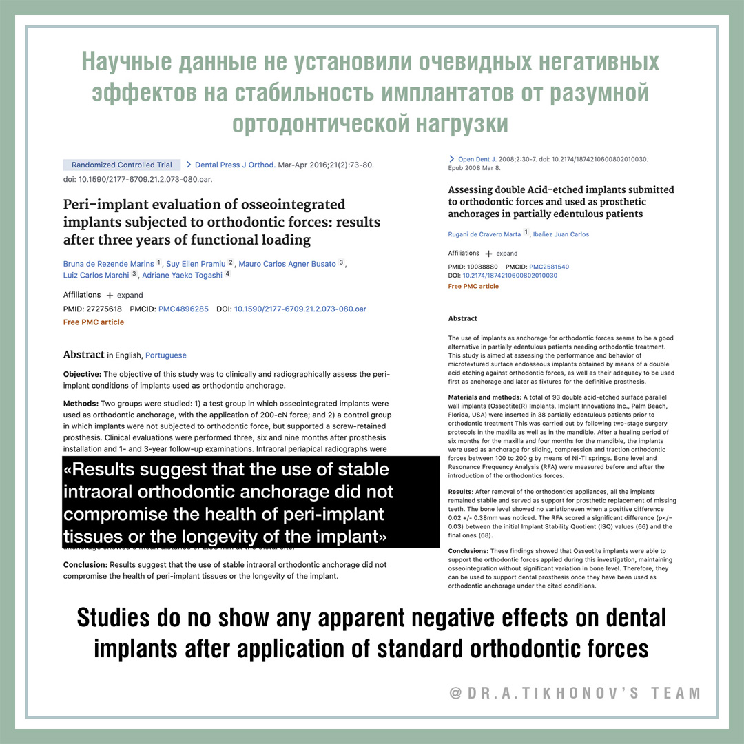 А.В. Тихонов – сужение зубного ряда с опорой на дентальный имплантат