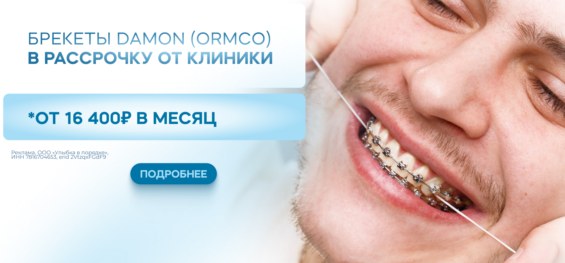 Рассрочка от клиники на брекеты — от 16400 рублей в месяц
