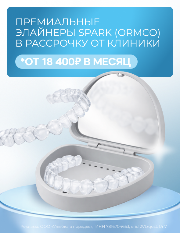 Премиальные элайнеры SPARK – в рассрочку от 18400 рублей в месяц