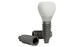 Реконструкция альвеолярного отростка