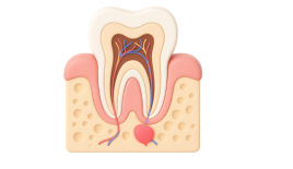 Реконструкция альвеолярного отростка