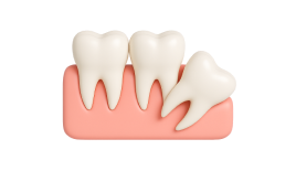 Реконструкция альвеолярного отростка