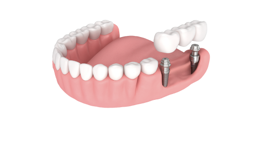 Культевая вкладка