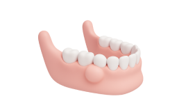 Реконструкция альвеолярного отростка