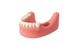 Реконструкция альвеолярного отростка