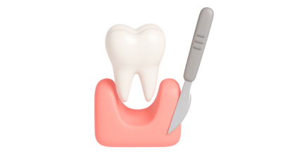 Реконструкция альвеолярного отростка