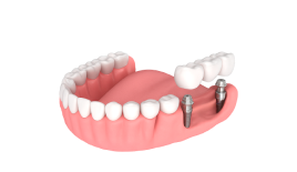 Культевая вкладка