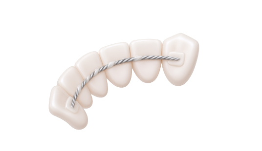 Лечение гингивита