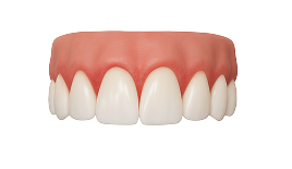 Лечение гингивита