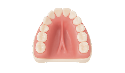 Лечение гингивита