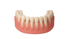 Лечение гингивита