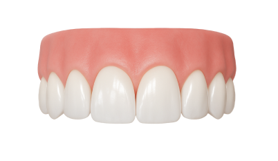 Композитная реставрация зубов