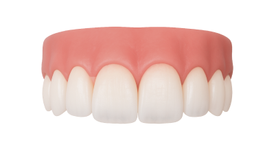 Композитная реставрация зубов