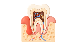 Лечение пришеечного кариеса