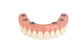 Реконструкция альвеолярного отростка