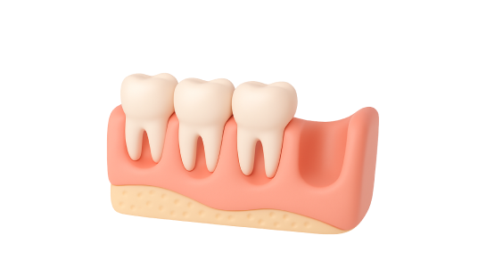 Реконструкция альвеолярного отростка